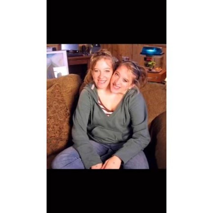 Conjoined Twins Abby and Brittany Hensel Family