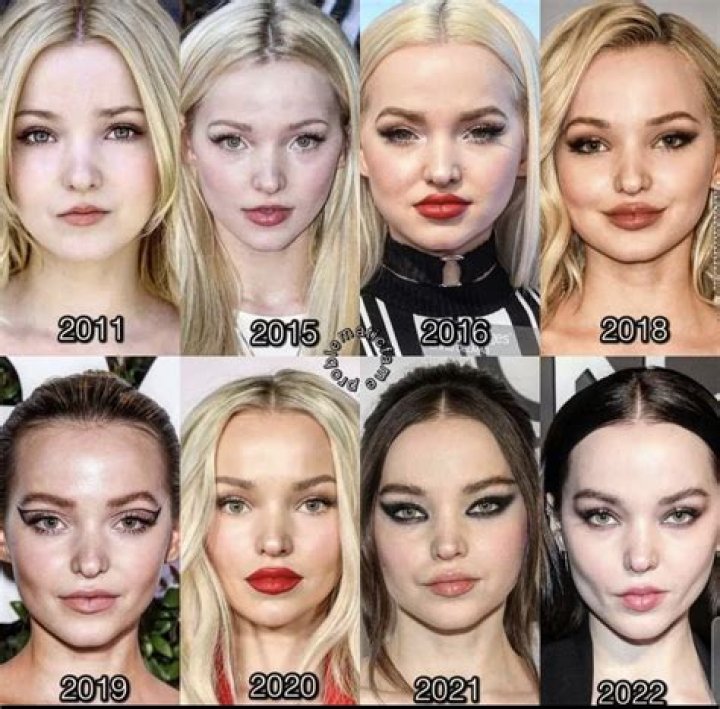 Dove Cameron's Surname Origin: Unveiling The Mystery Behind "Cameron"