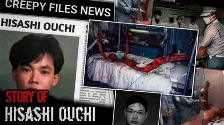 Exploring The Legacy Of Hisashi Ouchi: A Journey Into Hisashi Ouchi Skin