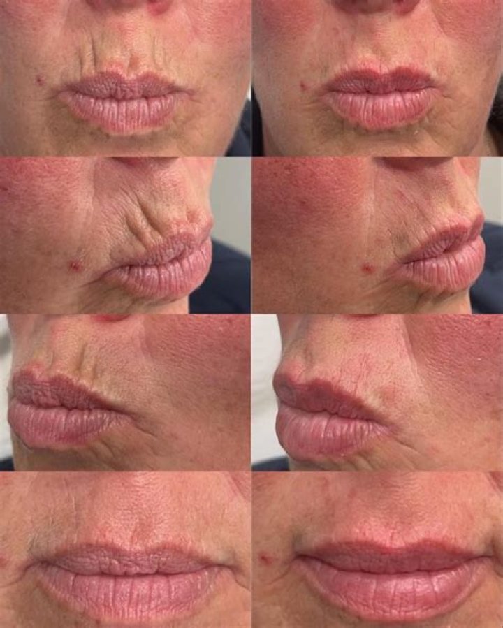 Julia Tica’s Plastic Surgery: The Internet Star Has Been Accused of Receiving Breast Implants, a Nose Job, Lip Fillers, and Chin Augmentation!