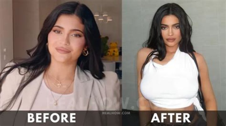 Kylie Jenner's Weight Loss Journey In 2024: A Comprehensive Overview