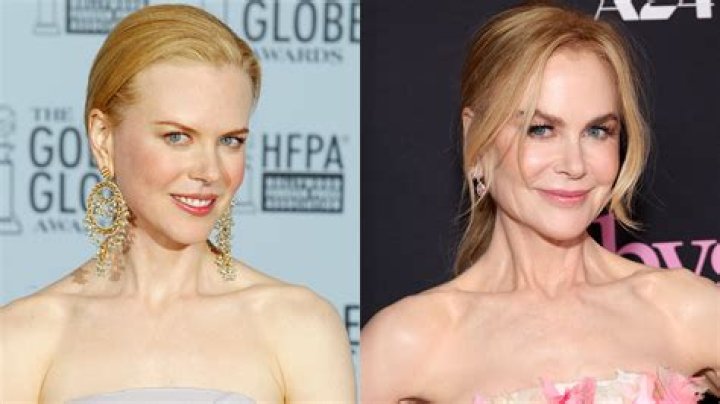 Nicole Kidman: The Truth Behind Her Plastic Surgery Rumors