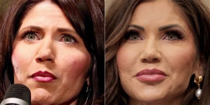Unraveling The Mystery: Did Kristi Noem Have Plastic Surgery?
