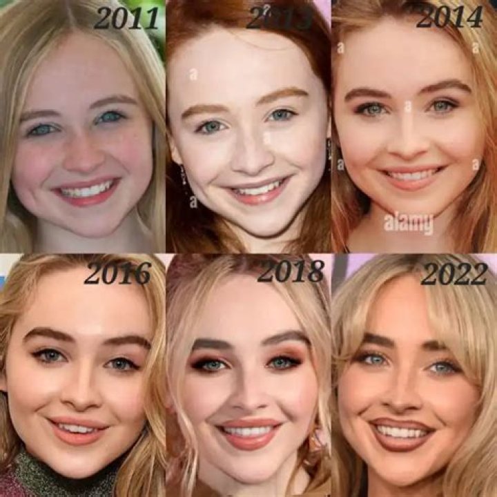 Unveiling The Transformation: Sabrina Carpenter's Face Change