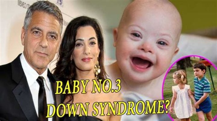 Unveiling The Truth: Is One Of George Clooney's Twins Down Syndrome?
